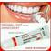 DenTek temparin max lost filling loose cap tooth repair kit
