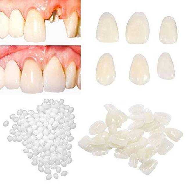 30ml Tooth Repair Kit,Missing Broken Tooth Repair Kit,Gap False